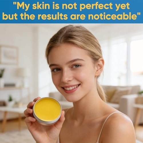 Acne & Redness Killer 2-Pack – Organic Acne Balm for All Skin Types Avelisse