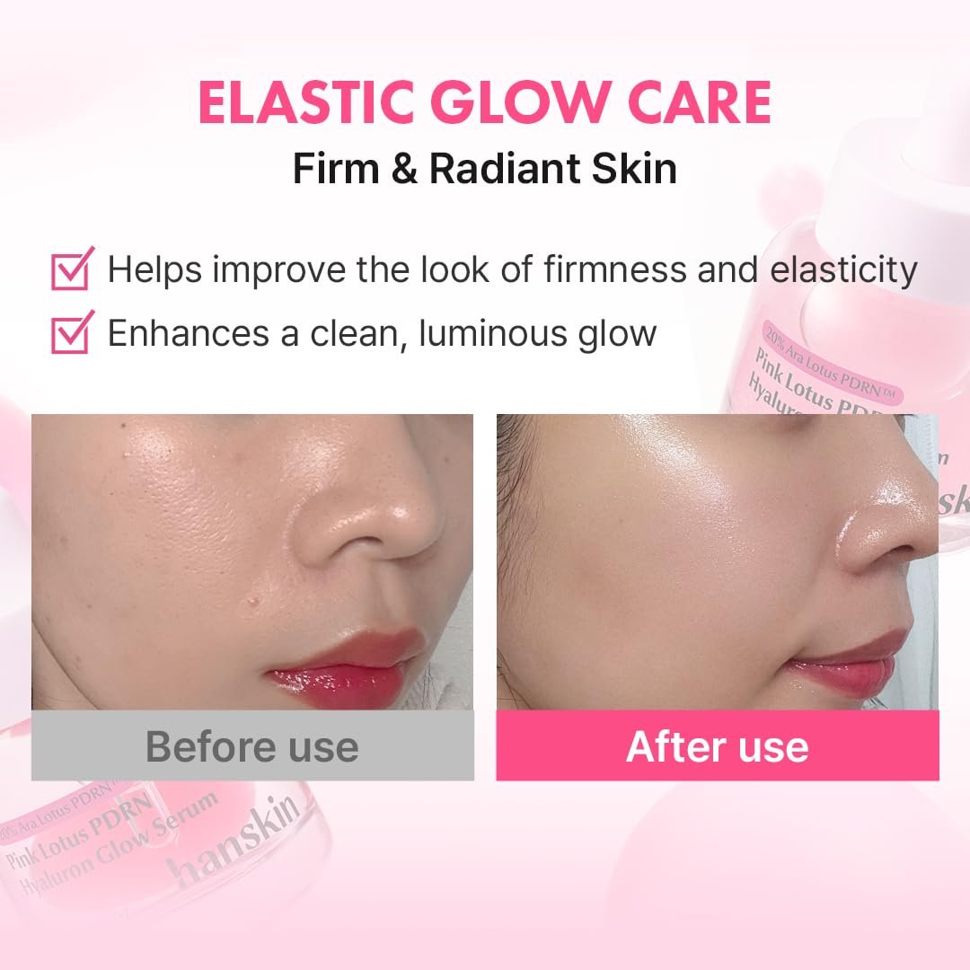 Hanskin PDRN Pink Peptide Hyaluron Glow Serum - 200,000ppm Pink Lotus Vegan PDRN | Intensive Hydrating Glow Ball Essence for Glass Skin, Plumping & Firming | Korean Skincare 1.01 fl. oz. Avelisse