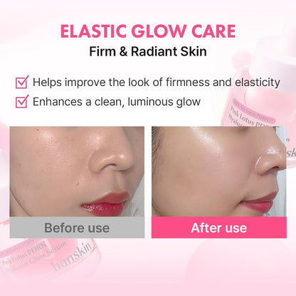 Hanskin PDRN Pink Peptide Hyaluron Glow Serum - 200,000ppm Pink Lotus Vegan PDRN | Intensive Hydrating Glow Ball Essence for Glass Skin, Plumping & Firming | Korean Skincare 1.01 fl. oz. Avelisse