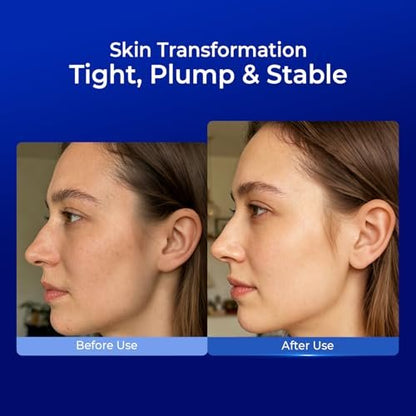 PROF.LING Full Spectrum Hyaluronic Acid Serum with Copper Peptides for Microneedling & Post Treatment Care - Anti Aging Firming Hydrating Soothing Repair Serum for Sensitive Skin Avelisse