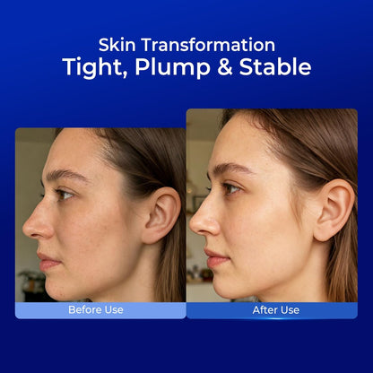 PROF.LING Full Spectrum Hyaluronic Acid Serum with Copper Peptides for Microneedling & Post Treatment Care - Anti Aging Firming Hydrating Soothing Repair Serum for Sensitive Skin Avelisse