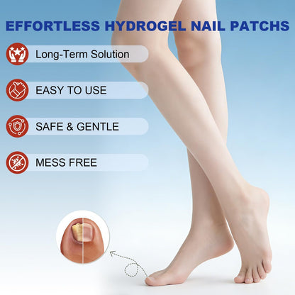 Nail Patches for Toenails - 2 Pack Toenail Stickers, 8-Hour Overnight Nail Patches, Fits Large & Small Nails, 42 Count (Blue A)