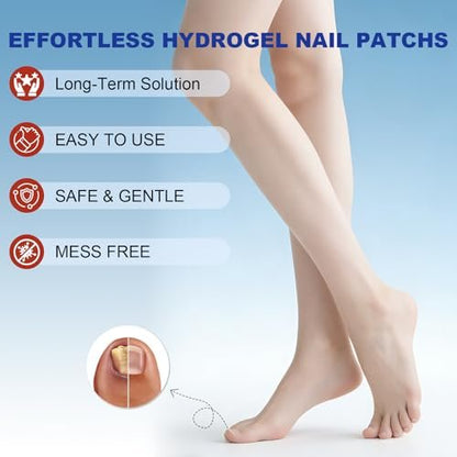 Nail Patches for Toenails - 2 Pack Toenail Stickers, 8-Hour Overnight Nail Patches, Fits Large & Small Nails, 42 Count (Blue A)