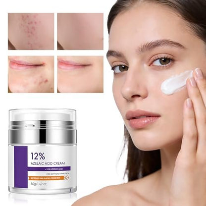 12% Azelaic Acid Cream for Face - Acne Treatment & Post-Acne Scar Fading, Regulates Sebum, Oily & Acne-Prone Skin Care, 1.69 oz