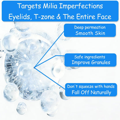 SERYNTH Milia Remover Essence - Fat Granule Clearing Skin Essence, Milia Removal Serum 30ml Avelisse