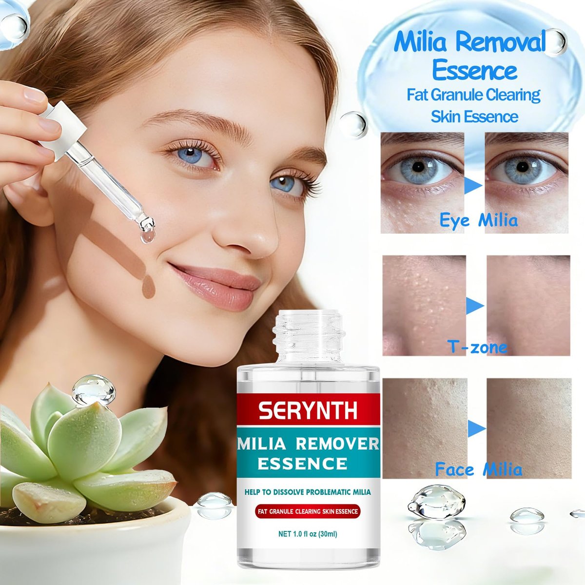 SERYNTH Milia Remover Essence - Fat Granule Clearing Skin Essence, Milia Removal Serum 30ml Avelisse