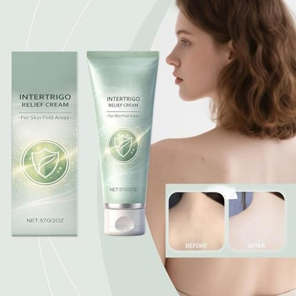 Ayland Healora Intertrigo Cream – Daily Skin Fold & Chafing Support with Moisture Barrier – Non-Steroid Formula for Friction-Prone Areas, 2 Oz Avelisse