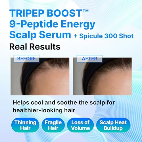 9-Peptide Hair Growth Scalp Care Serum 1.35 Oz (2X Size) - Rosemary 2% Caffeine 1% PDRN & Spicule 300 Roll-On Type | Thicker Fuller-Looking Hair with Niacinamide Zinc PCA | Thinning Hair Korean Haircare Avelisse