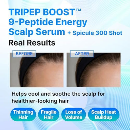 9-Peptide Hair Growth Scalp Care Serum 1.35 Oz (2X Size) - Rosemary 2% Caffeine 1% PDRN & Spicule 300 Roll-On Type | Thicker Fuller-Looking Hair with Niacinamide Zinc PCA | Thinning Hair Korean Haircare Avelisse