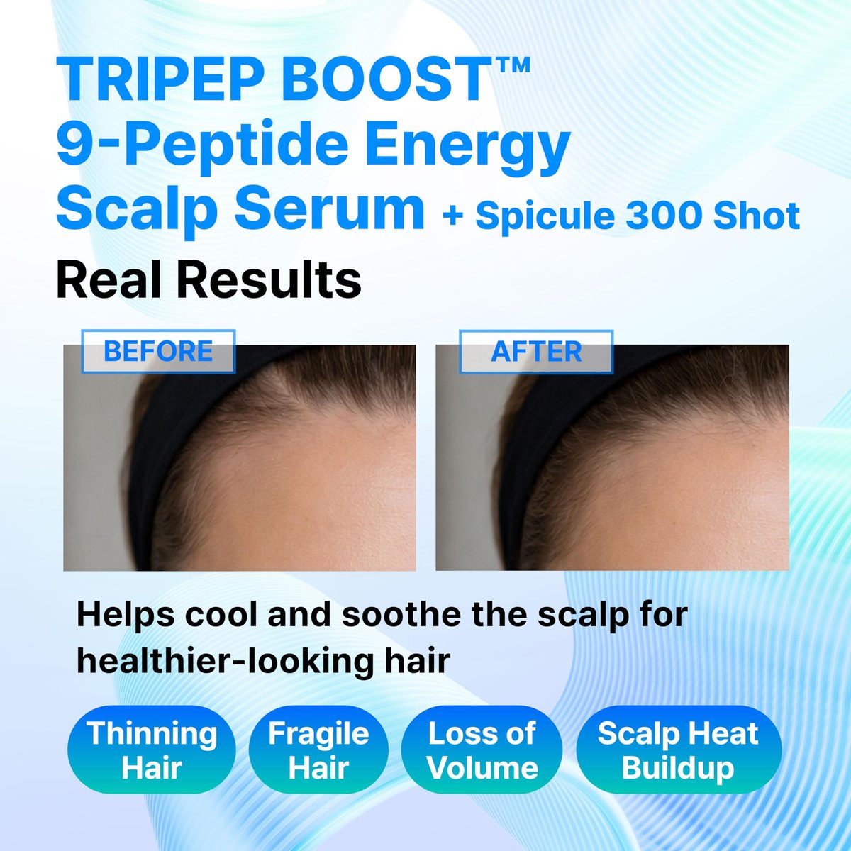 9-Peptide Hair Growth Scalp Care Serum 1.35 Oz (2X Size) - Rosemary 2% Caffeine 1% PDRN & Spicule 300 Roll-On Type | Thicker Fuller-Looking Hair with Niacinamide Zinc PCA | Thinning Hair Korean Haircare Avelisse