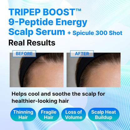 9-Peptide Hair Growth Scalp Care Serum 1.35 Oz (2X Size) - Rosemary 2% Caffeine 1% PDRN & Spicule 300 Roll-On Type | Thicker Fuller-Looking Hair with Niacinamide Zinc PCA | Thinning Hair Korean Haircare Avelisse