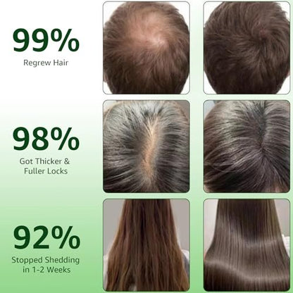 Hair Regrowth System with Ginseng, Eclipta Prostrata, Peppermint & Ginger Root - Supports Thicker-Looking, Stronger Hair for Men & Women (1 Fl Oz) Avelisse