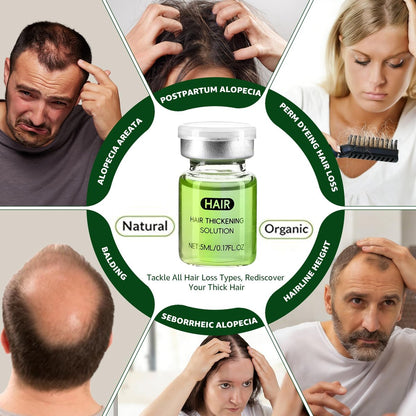 Hair Regrowth System with Ginseng, Eclipta Prostrata, Peppermint & Ginger Root - Supports Thicker-Looking, Stronger Hair for Men & Women (1 Fl Oz) Avelisse