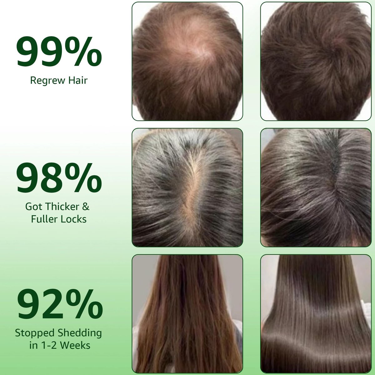 Hair Regrowth System with Ginseng, Eclipta Prostrata, Peppermint & Ginger Root - Supports Thicker-Looking, Stronger Hair for Men & Women (1 Fl Oz) Avelisse