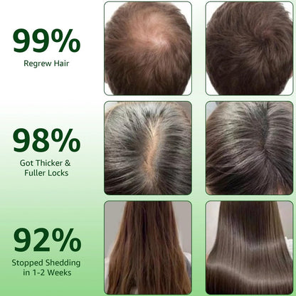 Hair Regrowth System with Ginseng, Eclipta Prostrata, Peppermint & Ginger Root - Supports Thicker-Looking, Stronger Hair for Men & Women (1 Fl Oz) Avelisse