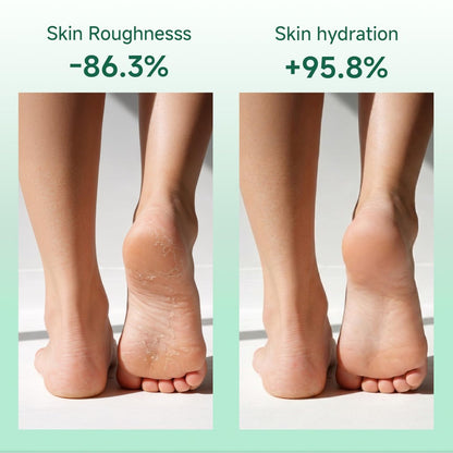 FAMIKYA 40% Urea Cream for Feet Maximum Strength - Foot Cream for Dry Cracked Heels with 2% Salicylic Acid, Moisturizer for Hands, Elbows, Knees, Rough Skin Avelisse