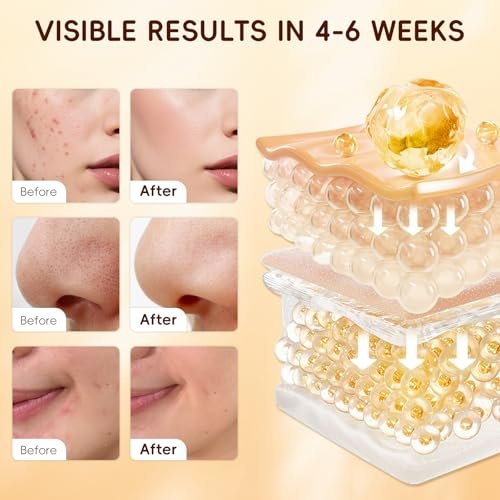 Turmeric Kojic Acid Cleansing Pads for Face – 60 Count Exfoliating & Brightening Facial Towelettes Avelisse