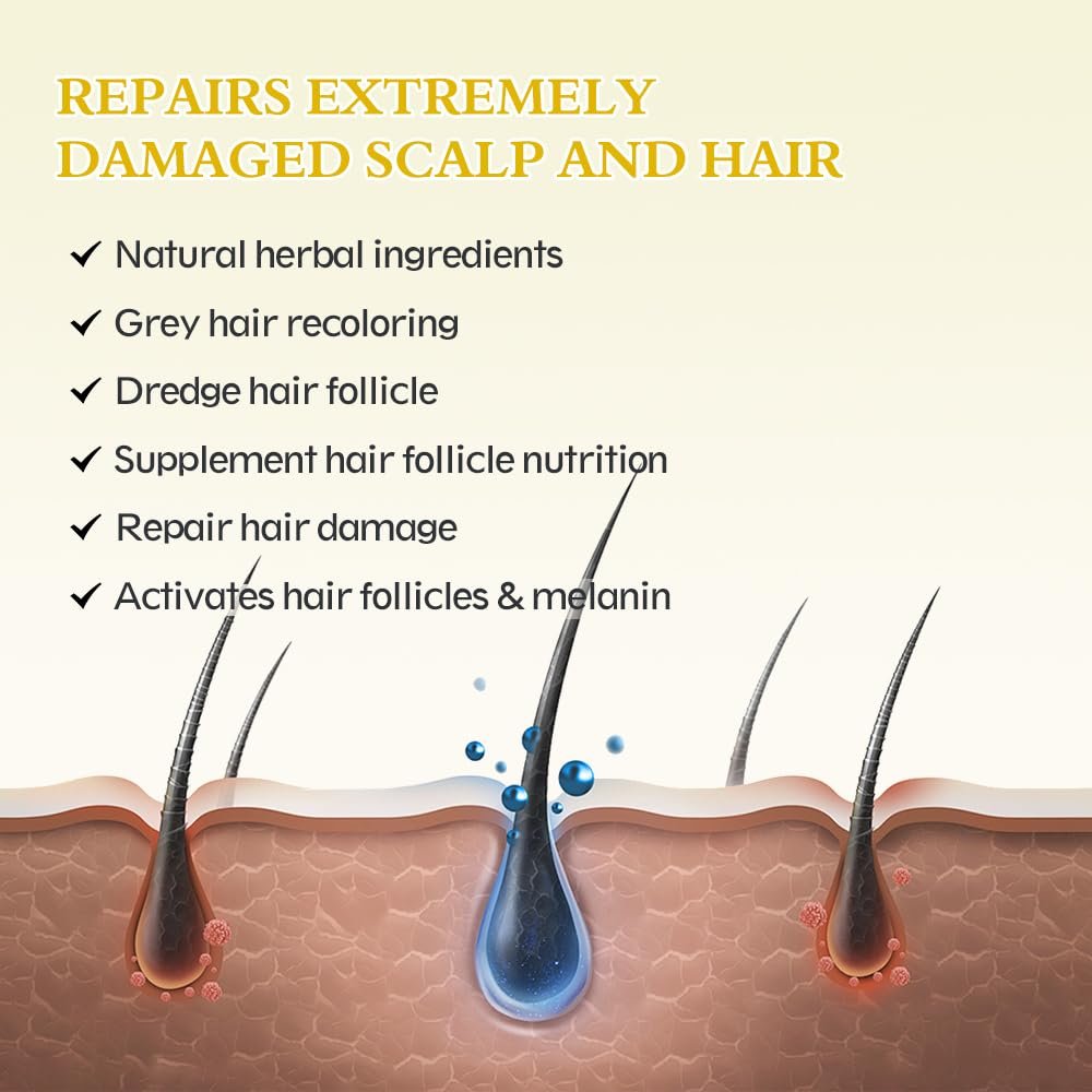 2-Pack 5% Minoxidil Hair Growth Serum - Hair Regrowth Treatment for Men and Women, Strengthens and Thickens Hair, Beard and Facial Hair Enhancer (2.1 Fl Oz Each) Avelisse