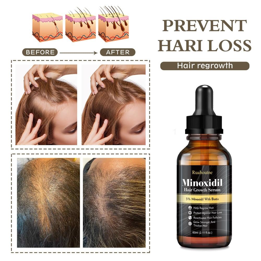 Ruahouine Hair Growth Treatment – 5% Minoxidil & Biotin Serum for Thicker, Longer Hair – Prevents Hair Loss & Thinning for Men and Women – 2.11 fl oz - görsel 7