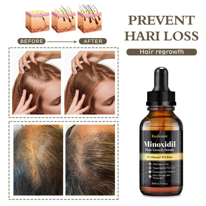 Ruahouine Hair Growth Treatment – 5% Minoxidil & Biotin Serum for Thicker, Longer Hair – Prevents Hair Loss & Thinning for Men and Women – 2.11 fl oz