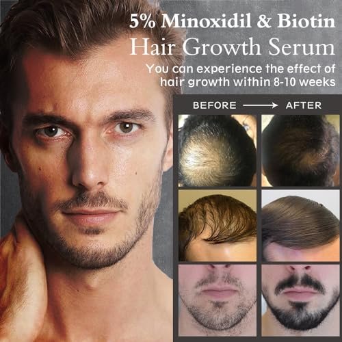 Ruahouine Hair Growth Treatment – 5% Minoxidil & Biotin Serum for Thicker, Longer Hair – Prevents Hair Loss & Thinning for Men and Women – 2.11 fl oz - görsel 10
