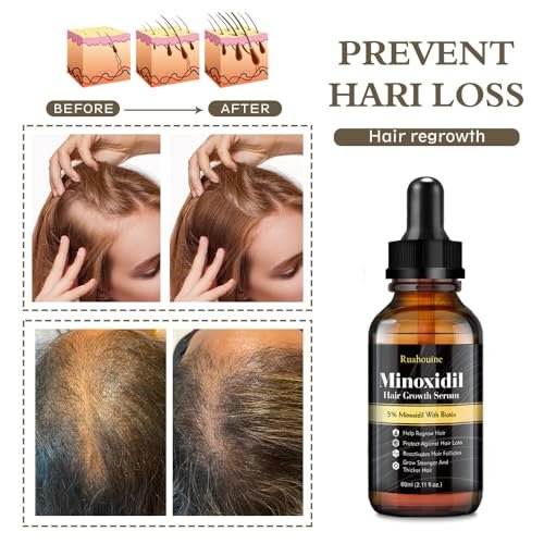 Ruahouine Hair Growth Treatment – 5% Minoxidil & Biotin Serum for Thicker, Longer Hair – Prevents Hair Loss & Thinning for Men and Women – 2.11 fl oz - görsel 8