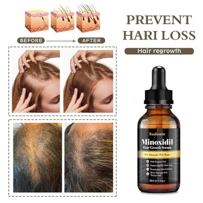 Ruahouine Hair Growth Treatment – 5% Minoxidil & Biotin Serum for Thicker, Longer Hair – Prevents Hair Loss & Thinning for Men and Women – 2.11 fl oz