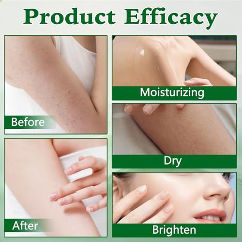 2-Pack Intertrigo Cream – Professional Skin Care for Chafing & Skin Fold Irritation Avelisse