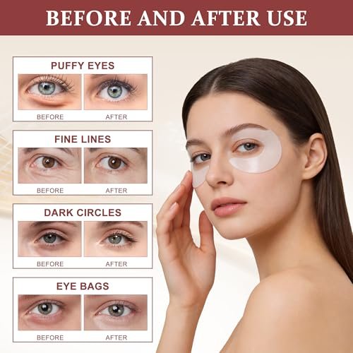Ycz Under Eye Patches (60 ct) – Caffeine Eye Masks for Puffy Eyes, Dark Circles & Fine Lines, Hydrating Collagen Masks with Niacinamide for Depuffing, Anti-Aging 360° Full Eye Care, Gifts for Women Avelisse