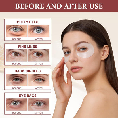 Ycz Under Eye Patches (60 ct) – Caffeine Eye Masks for Puffy Eyes, Dark Circles & Fine Lines, Hydrating Collagen Masks with Niacinamide for Depuffing, Anti-Aging 360° Full Eye Care, Gifts for Women Avelisse