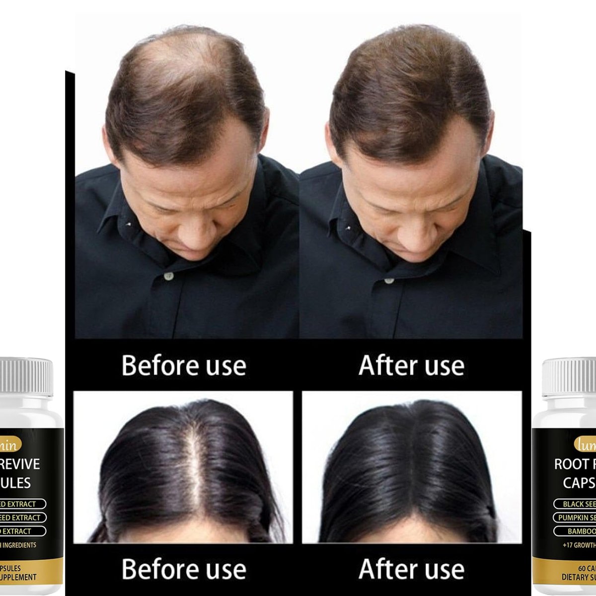 Lumin Root Revive Capsules for Hair Growth – Nourish Thinning Hair & Boost Thickness with Black Seed Extract, Biotin, Bamboo Extract, Saw Palmetto & 17 Growth Ingredients, 60 Count Avelisse