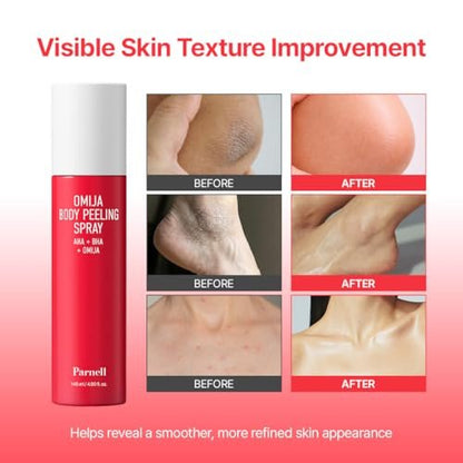 PARNELL AHA Omija Ceramic Body Peeling Spray – AHA BHA PHA Exfoliant for Keratosis Pilaris, Strawberry Legs, Dark Spots & Dead Skin – Chemical Exfoliant for Rough Skin, 4.60 fl.oz Avelisse