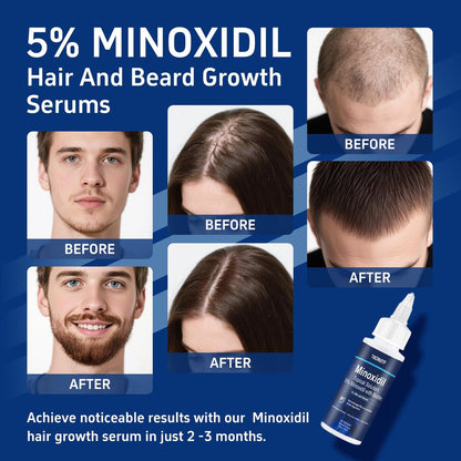 6 Pack 5% Minoxidil with Biotin Hair Growth Treatment for Men and Women, Thicker Fuller Hair & Beard Serum, 12 fl oz (6 Month Supply) Avelisse