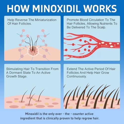 6 Pack 5% Minoxidil with Biotin Hair Growth Treatment for Men and Women, Thicker Fuller Hair & Beard Serum, 12 fl oz (6 Month Supply) Avelisse