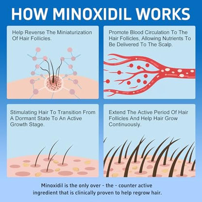 6 Pack 5% Minoxidil with Biotin Hair Growth Treatment for Men and Women, Thicker Fuller Hair & Beard Serum, 12 fl oz (6 Month Supply) Avelisse