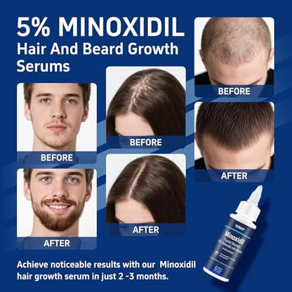 6 Pack 5% Minoxidil with Biotin Hair Growth Treatment for Men and Women, Thicker Fuller Hair & Beard Serum, 12 fl oz (6 Month Supply) Avelisse