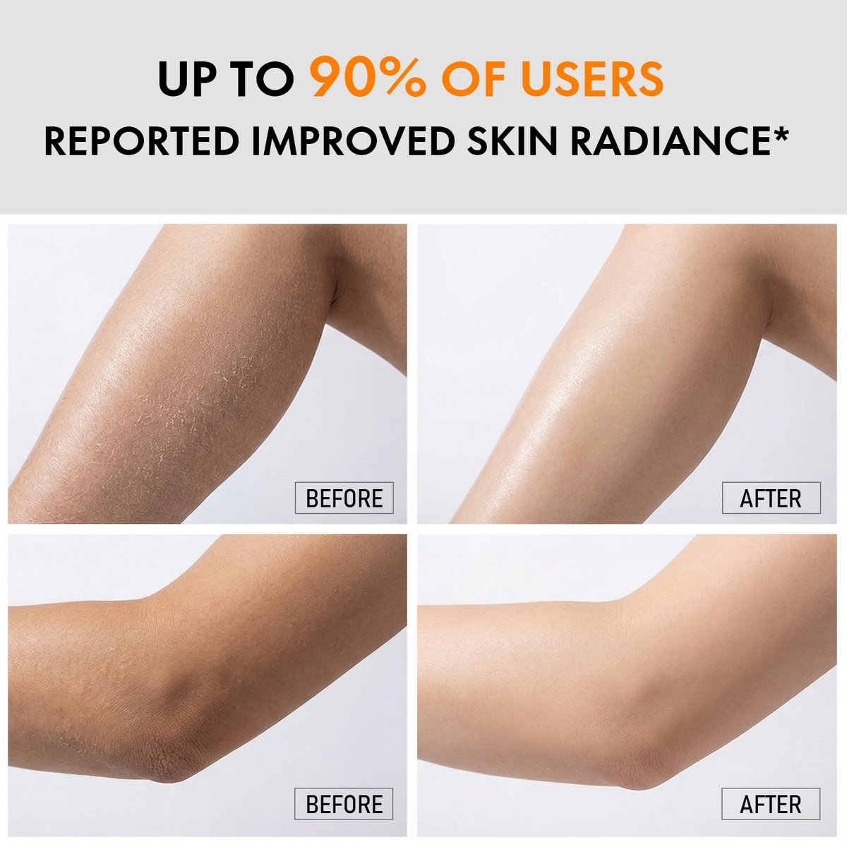 Kojic Acid & Turmeric Body Care Spray - Gentle Exfoliating Texture Care with Soft Sponge Applicator, Daily Body Skin Care for All Skin Types, 200ml Avelisse