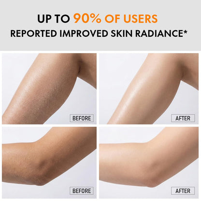Kojic Acid & Turmeric Body Care Spray - Gentle Exfoliating Texture Care with Soft Sponge Applicator, Daily Body Skin Care for All Skin Types, 200ml Avelisse