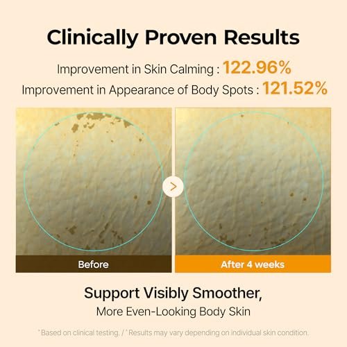 Dr.Melaxin Kojic Acid Turmeric Body Cream with Ceramides – Brightening Body Moisturizer for Dark Spots & Uneven Tone, Panthenol & Hyaluronic Acid for Deep Hydration, 7.05 oz Avelisse