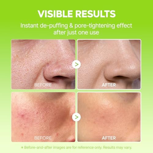 Dr.Melaxin Cactox Pore Relief Jelly Serum Mist - Instant Cooling Face Mist for Pore Tightening & De-Puffing, Hydrating Cactus Serum for Puffy Skin, 80ml (2.7 fl oz) Avelisse