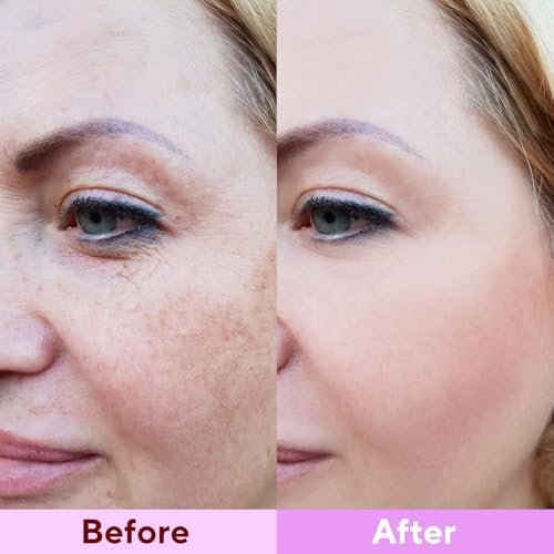 Nityrliv Bio-Collagen Real Deep Mask – Overnight Hydrating Face Mask, 4 Pack for All Skin Types - görsel 14