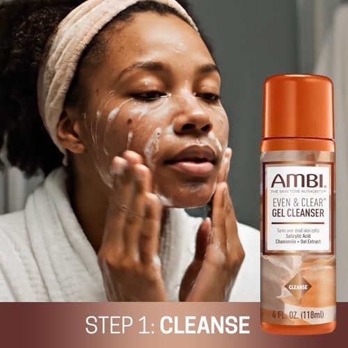 Ambi Even & Clear Daily Skin Tone Kit – 3-Step Regimen for Acne, Dark Spots & Uneven Tone with Salicylic Acid & Niacinamide Avelisse