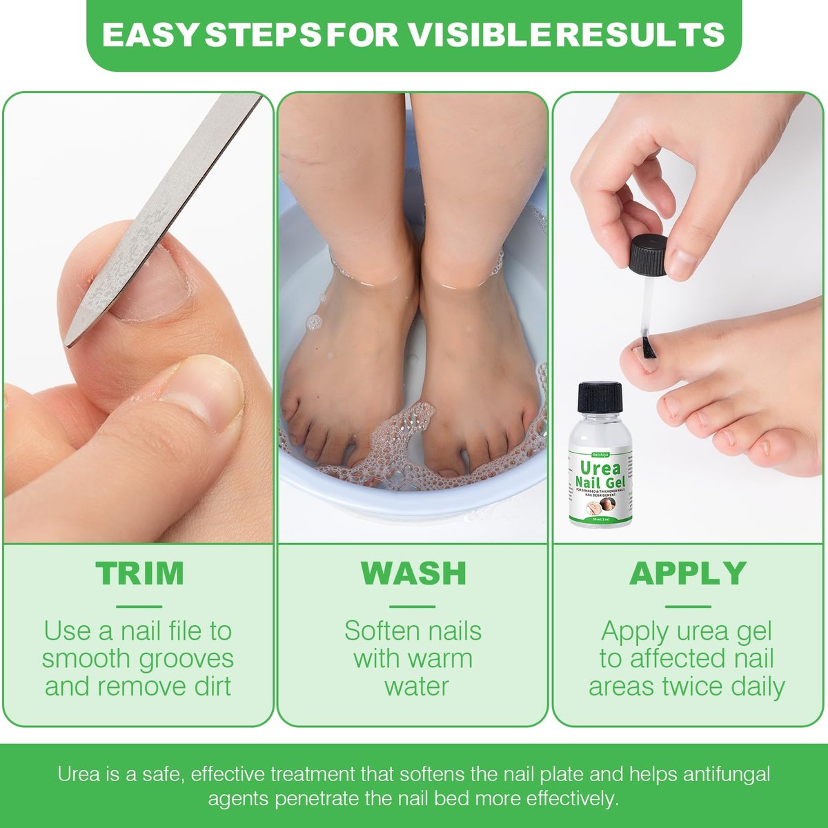 ZERBI 47% Urea Nail Gel – Medical-Grade Softening for Thick Toenails & Cracked Heel Calluses, Quick-Drying Formula Restores Nail Strength & Clarity, 1 Fl Oz Avelisse