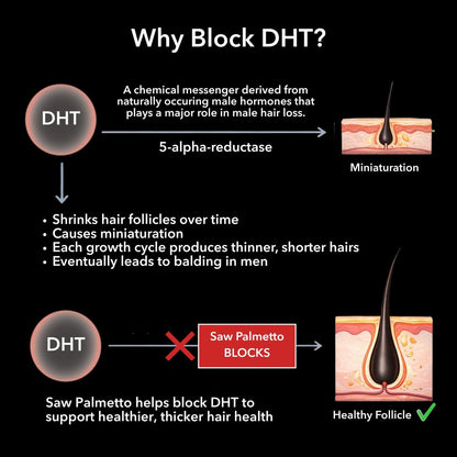 DHT Blocker for Men with Biotin 10000mcg - Saw Palmetto & MSM for Healthy Hair Growth - Vegan, Non-GMO, Gluten Free - 30 Servings