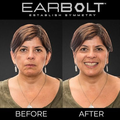 EARBOLT Ear Pinning Adhesives - Cosmetic Ear Correctors, Pack of 20 - Non-Surgical Ear Reshaping for Protruding Ears Avelisse