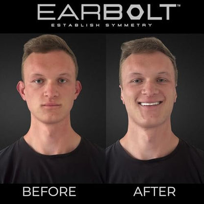 EARBOLT Ear Pinning Adhesives - Cosmetic Ear Correctors, Pack of 20 - Non-Surgical Ear Reshaping for Protruding Ears Avelisse
