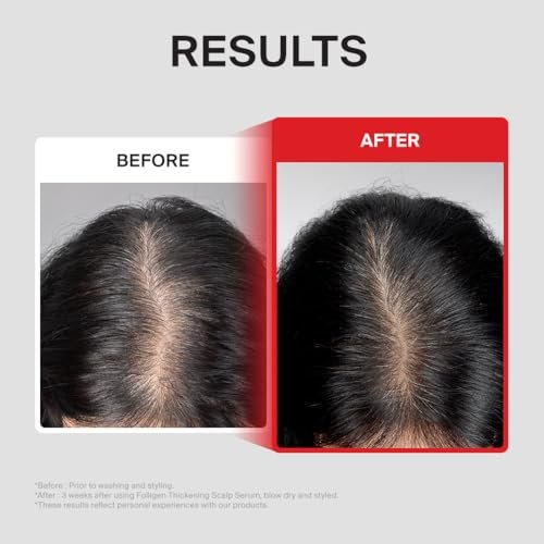 Dr.FORHAIR Folligen Thickening Scalp Serum 1.7 oz | Biotin Density Serum for Thicker, Fuller-Looking Hair | Peptide Scalp Treatment | Korean Haircare Avelisse