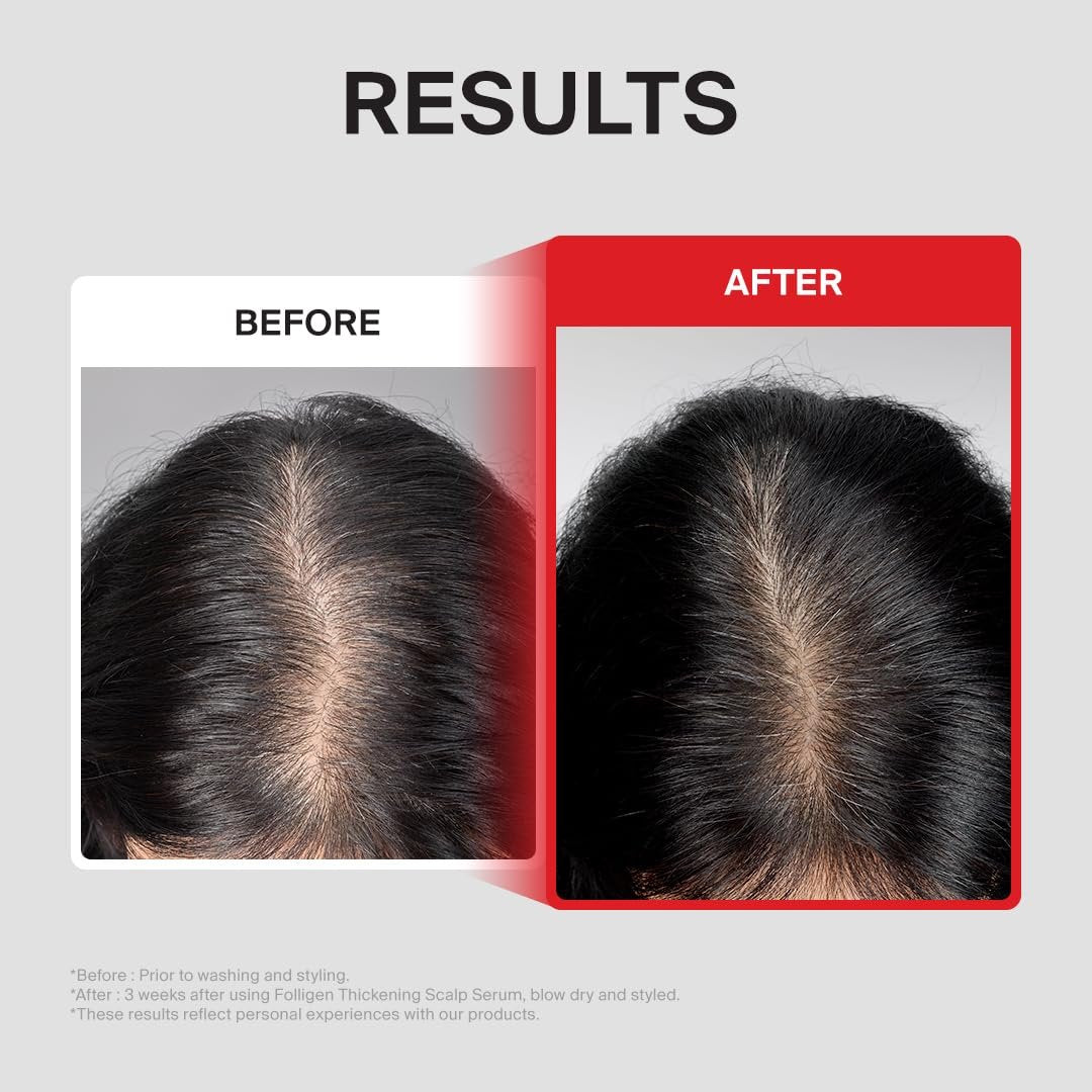 Dr.FORHAIR Folligen Thickening Scalp Serum 1.7 oz | Biotin Density Serum for Thicker, Fuller-Looking Hair | Peptide Scalp Treatment | Korean Haircare Avelisse