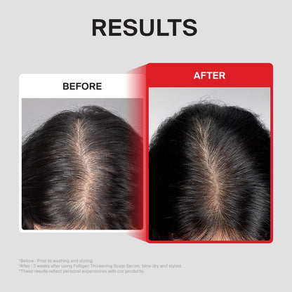 Dr.FORHAIR Folligen Thickening Scalp Serum 1.7 oz | Biotin Density Serum for Thicker, Fuller-Looking Hair | Peptide Scalp Treatment | Korean Haircare Avelisse