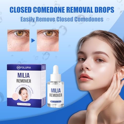 Milia Remover Treatment Serum with Salicylic Acid - Eye & Face Milia Spot Treatment, 1 Fl Oz Avelisse
